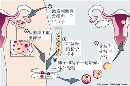同志借卵代怀咨询哪家好